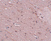 2 - TMEM16B Antibody ASC10991