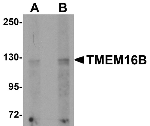 1 - TMEM16B Antibody ASC10991