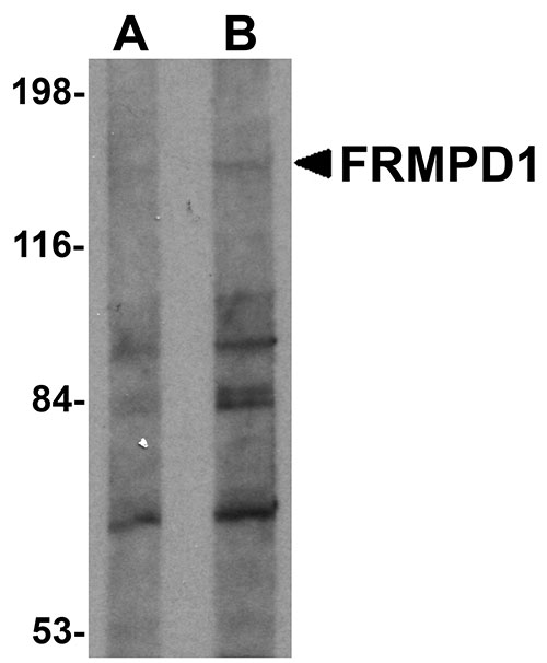 1 - FRMPD1 Antibody ASC11002