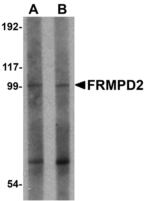 1 - FRMPD2 Antibody ASC11003