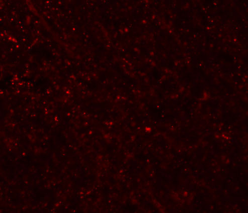 3 - FRMPD3 Antibody ASC11004