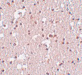 2 - FRMPD3 Antibody ASC11004