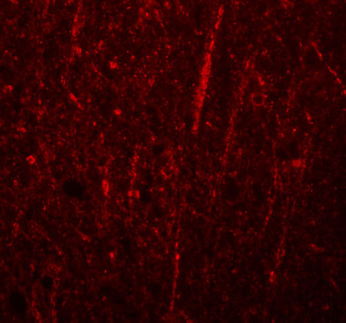 3 - FRMPD4 Antibody ASC11005