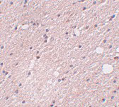 2 - FRMPD4 Antibody ASC11005