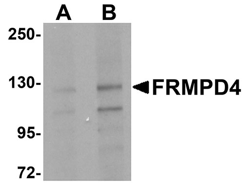 1 - FRMPD4 Antibody ASC11005