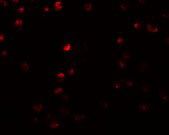 3 - OCIAD2 Antibody ASC11007