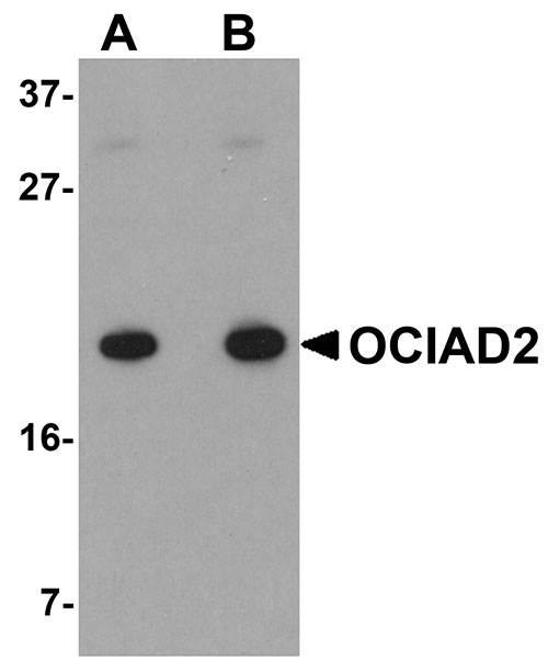 1 - OCIAD2 Antibody ASC11007