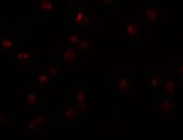 3 - OCIAD2 Antibody ASC11008
