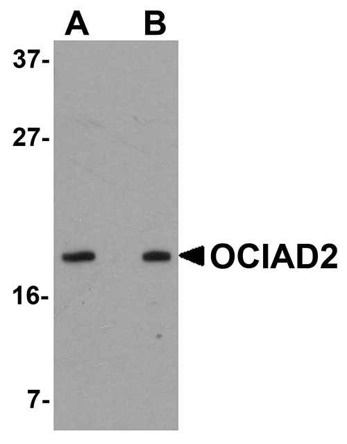 1 - OCIAD2 Antibody ASC11008