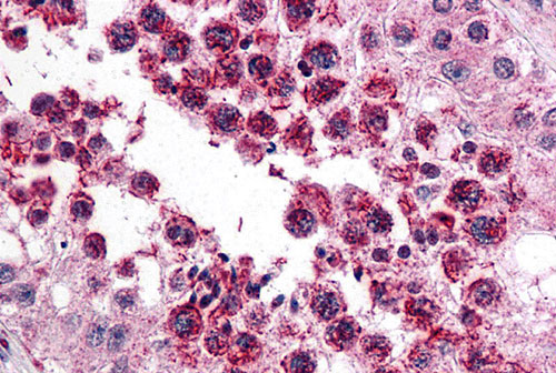 2 - SLAIN2 Antibody ASC11010