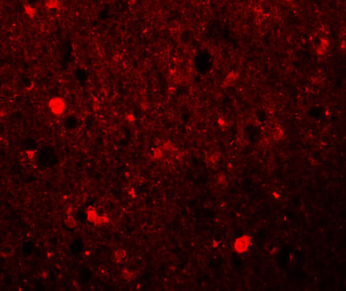3 - SRPX1 Antibody ASC11011