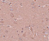2 - SRPX1 Antibody ASC11011