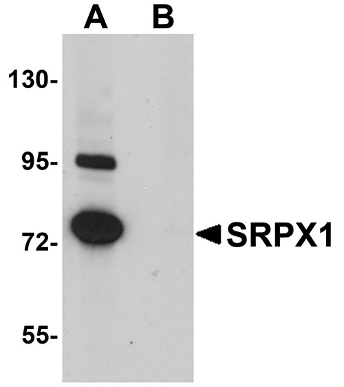 1 - SRPX1 Antibody ASC11011
