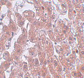 2 - FAM59A Antibody ASC11013
