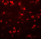 3 - FAM59B Antibody ASC11014