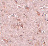 2 - FAM59B Antibody ASC11014