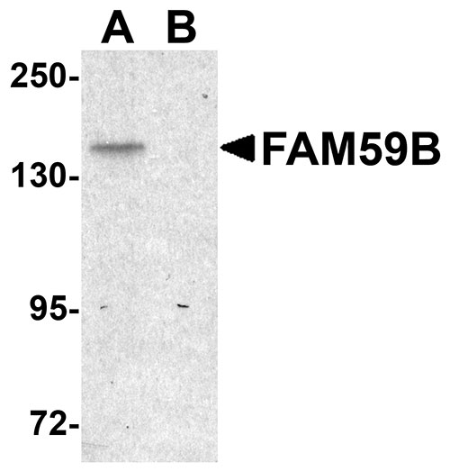 1 - FAM59B Antibody ASC11014