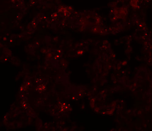 3 - PLEKHM1 Antibody ASC11015