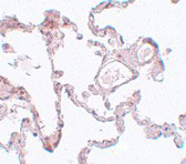 2 - PLEKHM1 Antibody ASC11015