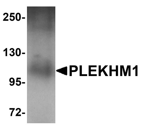 1 - PLEKHM1 Antibody ASC11015