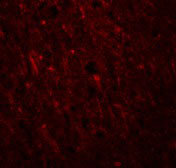 3 - PLEKHM2 Antibody ASC11016