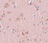 2 - PLEKHM2 Antibody ASC11016
