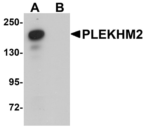 1 - PLEKHM2 Antibody ASC11016
