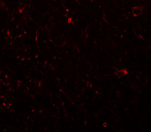 3 - PLEKHM3 Antibody ASC11017