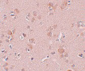 2 - PLEKHM3 Antibody ASC11017