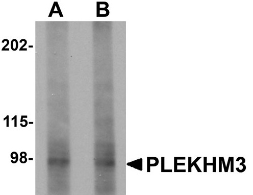 1 - PLEKHM3 Antibody ASC11017