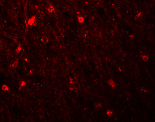 3 - SIPA1L1 Antibody ASC11018