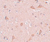 2 - SIPA1L1 Antibody ASC11018