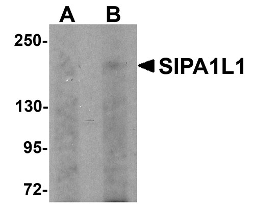 1 - SIPA1L1 Antibody ASC11018