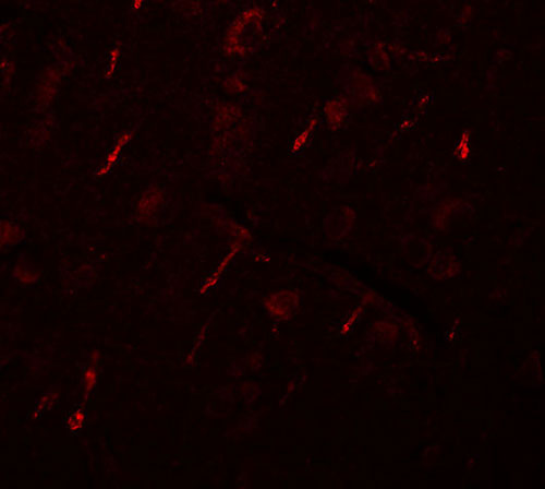 3 - SIPA1L2 Antibody ASC11019