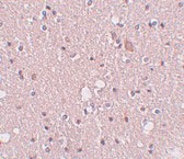 2 - SIPA1L2 Antibody ASC11019