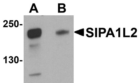 1 - SIPA1L2 Antibody ASC11019