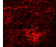 3 - SIPA1L3 Antibody ASC11020