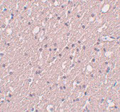 2 - SIPA1L3 Antibody ASC11020