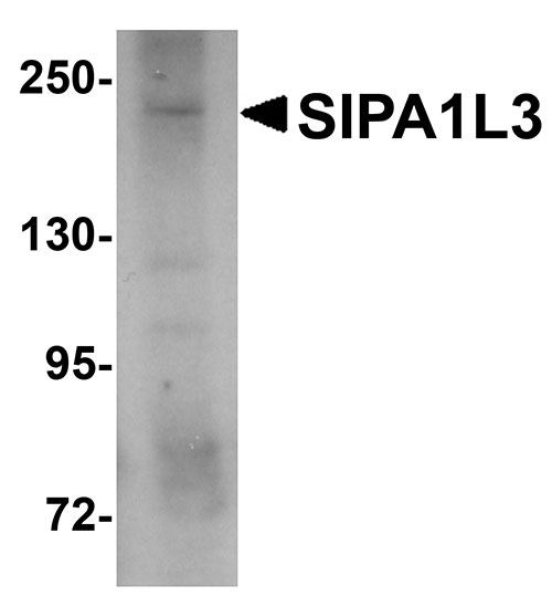 1 - SIPA1L3 Antibody ASC11020