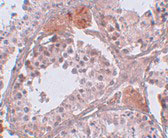 2 - CLPH Antibody ASC11021