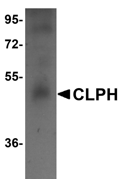 1 - CLPH Antibody ASC11021