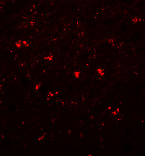 3 - PPAPDC1A Antibody ASC11026