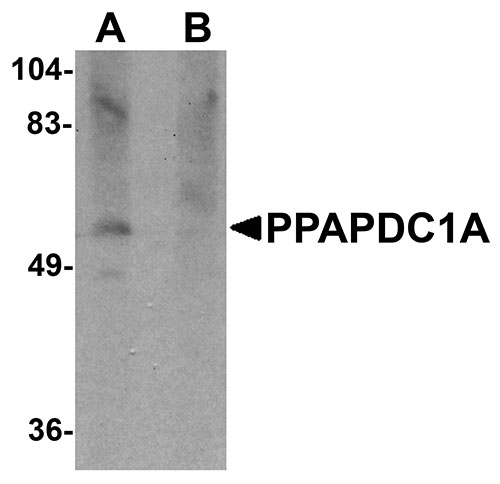 1 - PPAPDC1A Antibody ASC11026