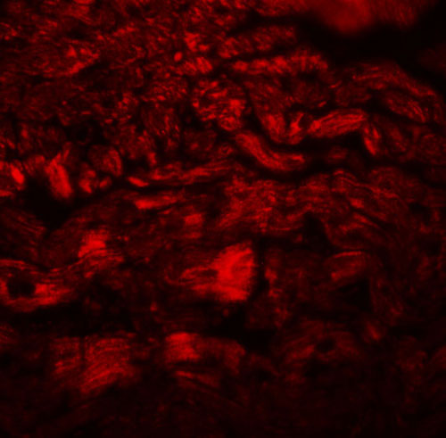 3 - PPAPDC3 Antibody ASC11029