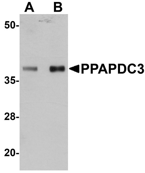 1 - PPAPDC3 Antibody ASC11029