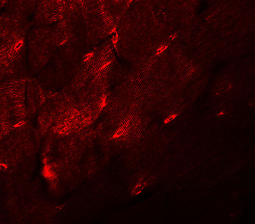 3 - TMEM38A Antibody ASC11030