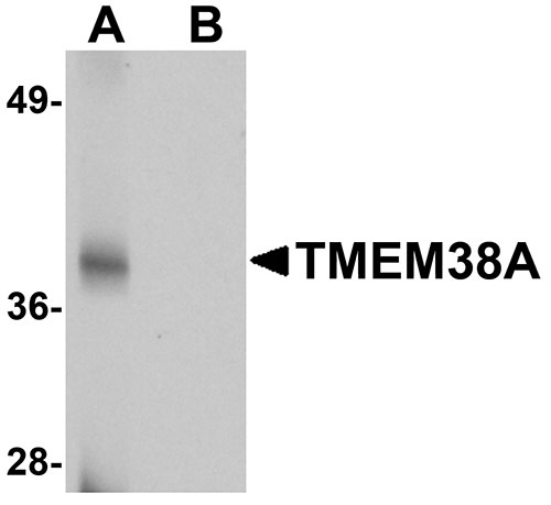 1 - TMEM38A Antibody ASC11030