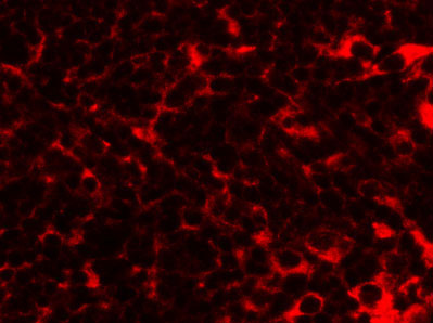 3 - TMEM38B Antibody ASC11031