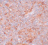 2 - TMEM38B Antibody ASC11031