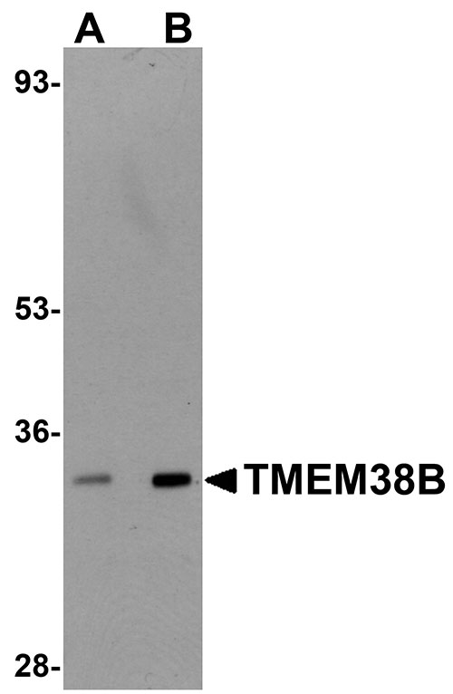 1 - TMEM38B Antibody ASC11031